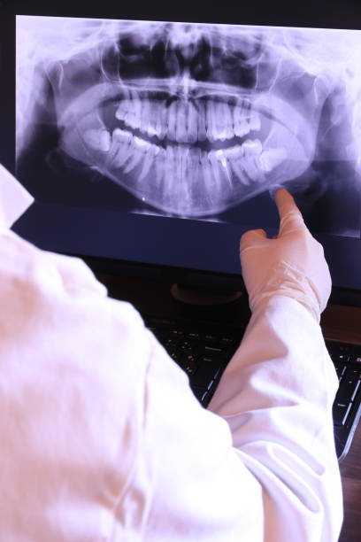 Best Emergency Dental Care for Broken or Chipped Teeth in Princeton, FL