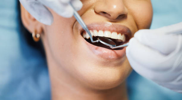 Best Emergency Dental Care for Broken or Chipped Teeth in Princeton, FL
